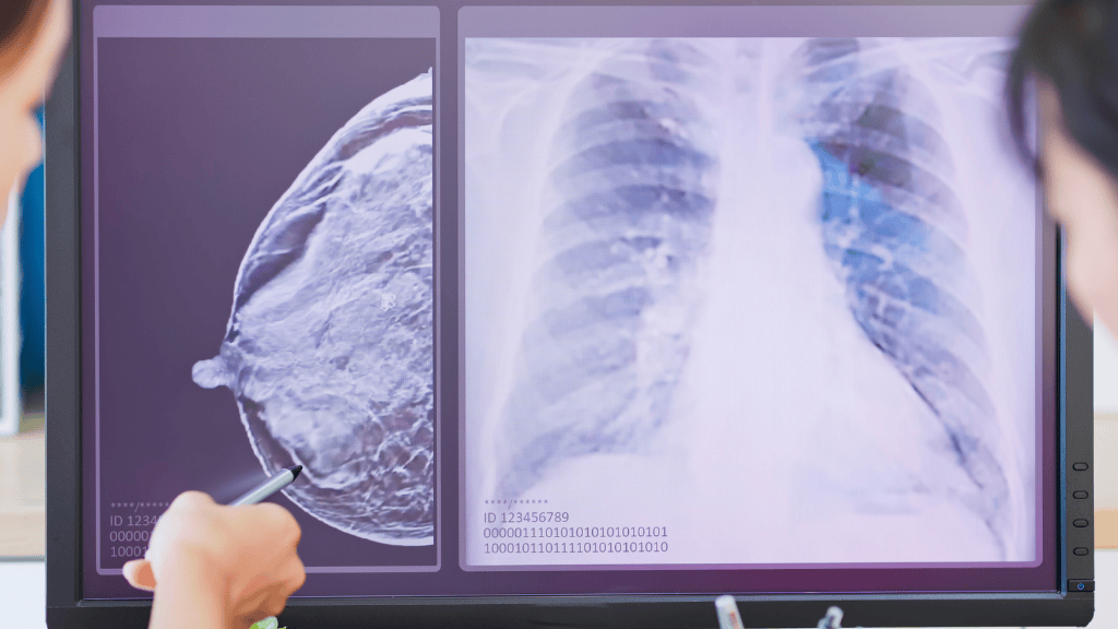 Woman undergoing AI-supported mammography screening at an advanced breast imaging center