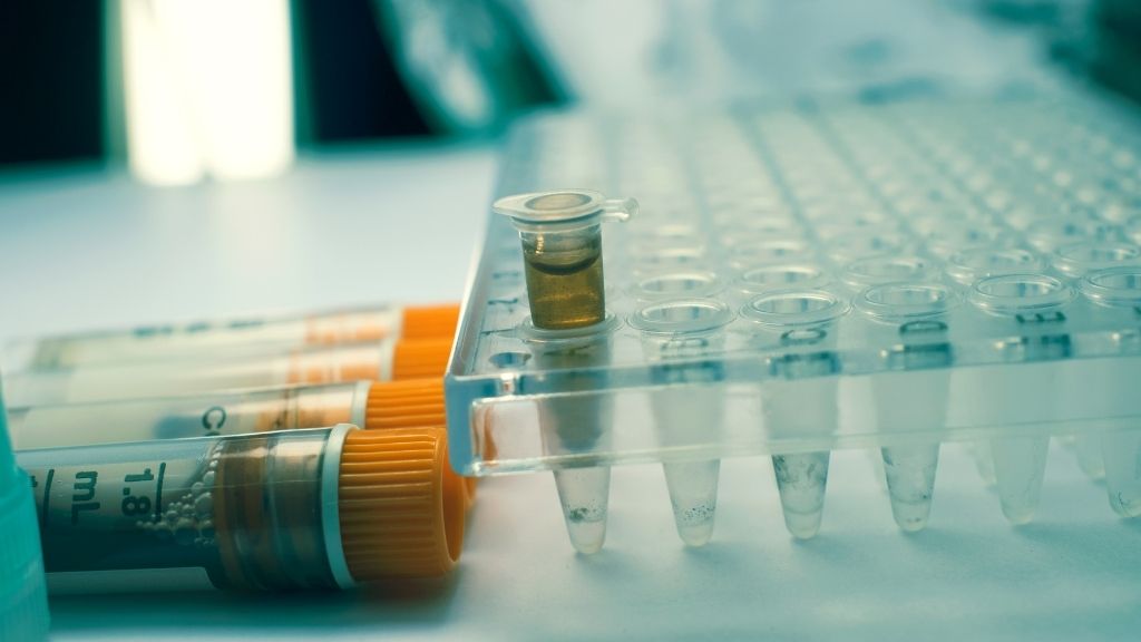 Laboratory samples used for biomarker testing in immunotherapy evaluation