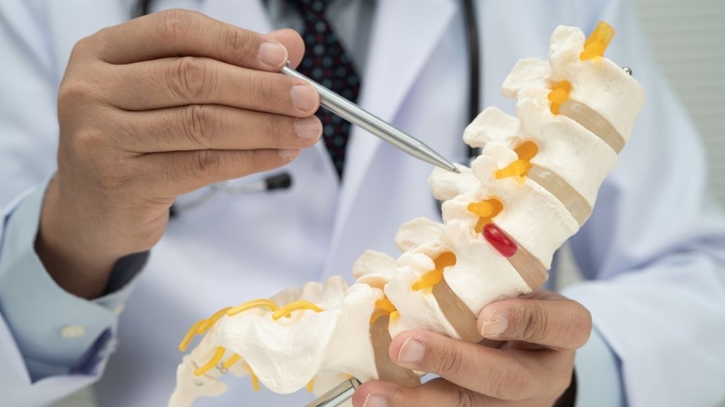 Un especialista en columna vertebral explica la estenosis espinal utilizando un modelo anatómico.